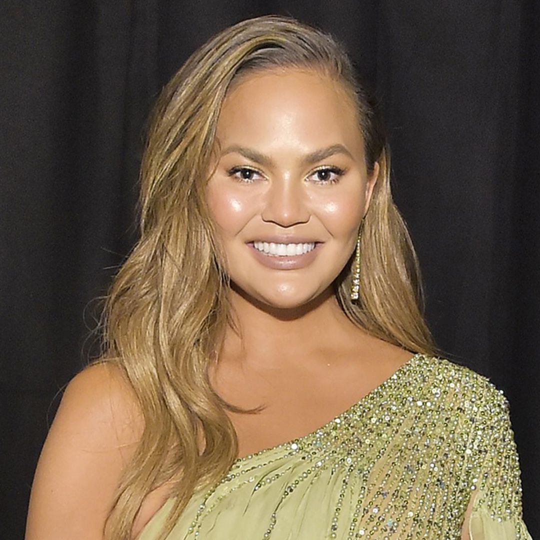 Chrissy Teigen Aesthetic Treatments - Hair Transplant Turkey | Turkeyana